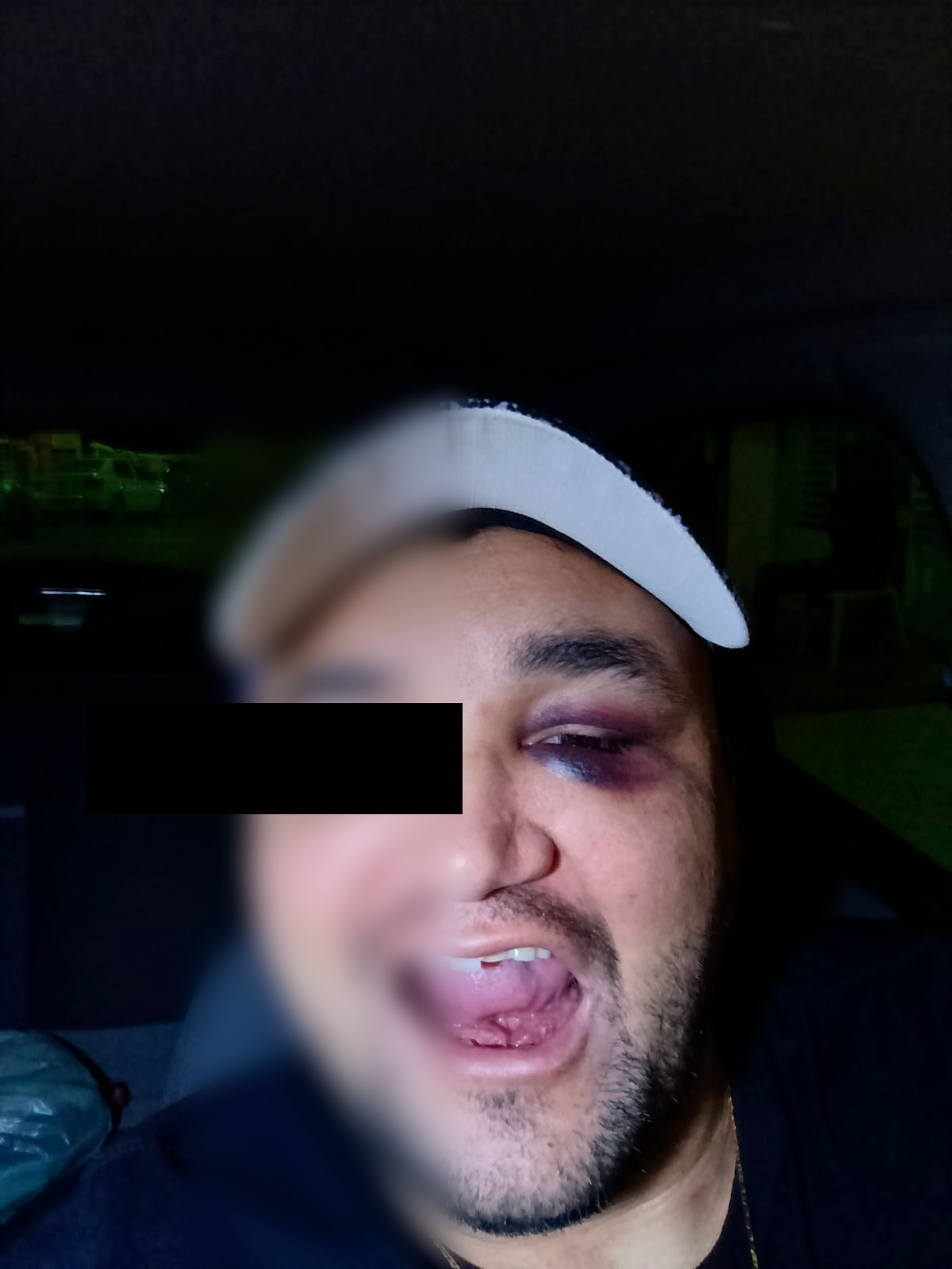 O que realmente aconteceu na confusão da Festa de Julho em Parnamirim?