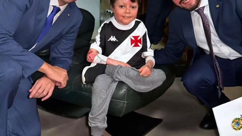 Câmara aprova projeto de coautoria de Lula da Fonte, para indenizar pacientes com epidermólise bolhosa