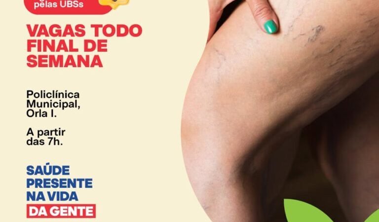 Mutirão de Tratamento de Varizes ultrapassa 4 mil atendimentos e segue com ações aos finais de semana em Juazeiro