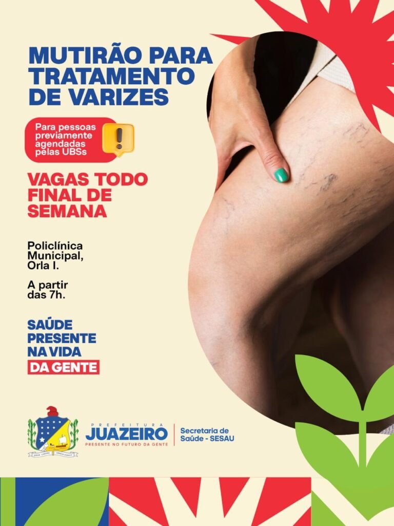 Mutirão de Tratamento de Varizes ultrapassa 4 mil atendimentos e segue com ações aos finais de semana em Juazeiro