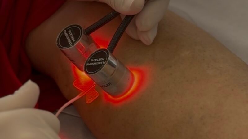 Prefeitura de Casa Nova amplia oferta de serviços de saúde e atende mais de 130 mulheres com escleroterapia